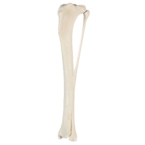 AV260ESP - LEFT CANINE TIBIA WITH FIBULA, MED. CANAL AND CANC. MATERIAL
