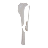 12725 - RADIOPAQUE LEFT CANINE TIBIA WITH MED. CANAL, CANC. MATERIAL AND DOUBLE MEDIAL FX