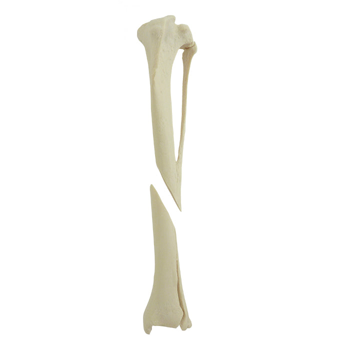 12724 - LEFT TIBIA WITH RADIOPAQUE DISTAL FRACTURE - BIG DOG