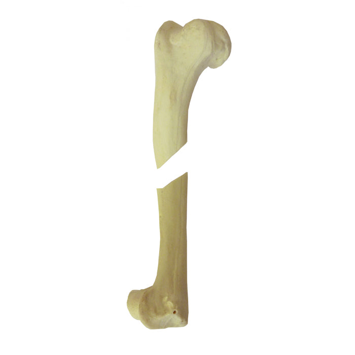 12548 - RIGHT CANINE HUMERUS WITH CANC. MATERIAL, MED. CANAL AND FX