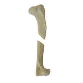 12548 - RIGHT CANINE HUMERUS WITH CANC. MATERIAL, MED. CANAL AND FX