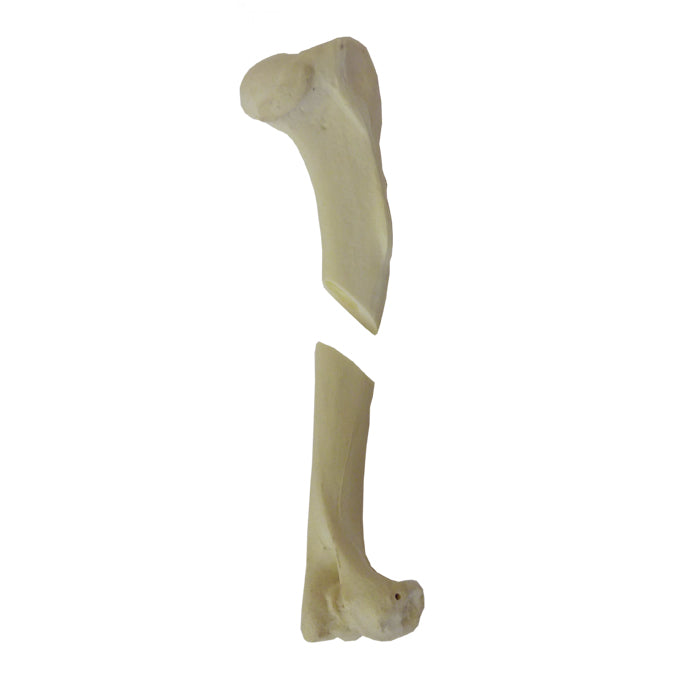 12548 - RIGHT CANINE HUMERUS WITH CANC. MATERIAL, MED. CANAL AND FX