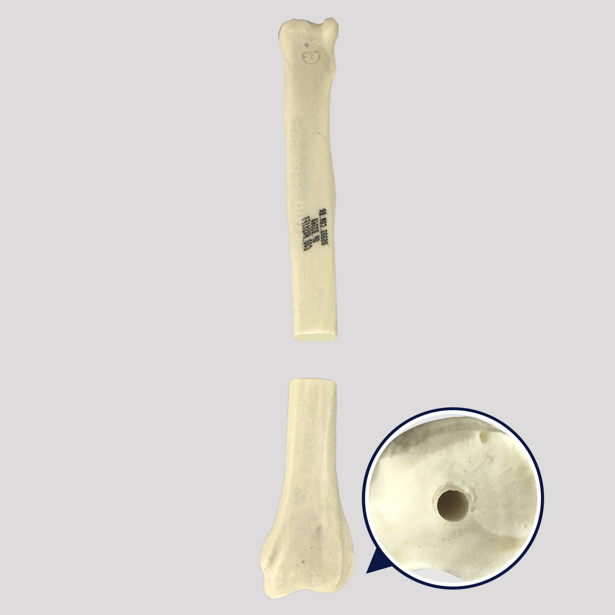 AV311F1 - RIGHT CANINE RADIUS WITH MED. CANAL AND TRANSVERSE FX