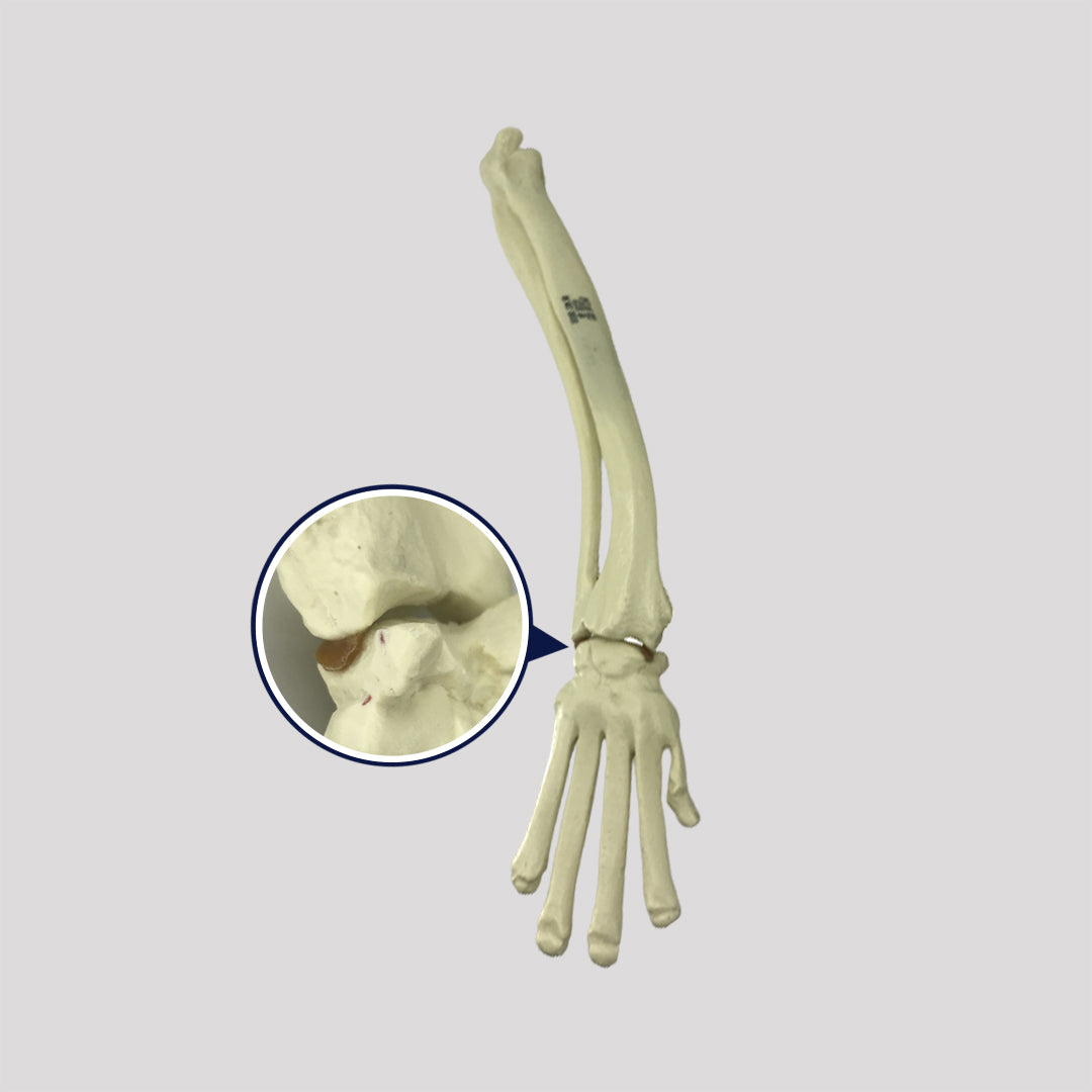 AV726 D - RIGHT CANINE ANTERIOR LIMB WITH DEFORMITY (WITHOUT HUMERUS)