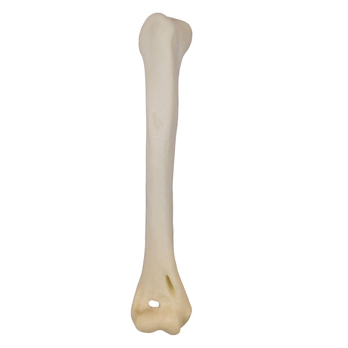 AV180 D - RIGHT HUMERUS - CAT