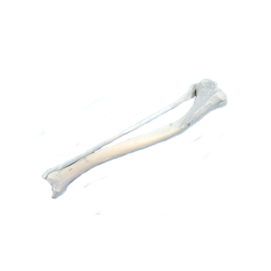 12690 - RIGHT CANINE TIBIA WITH FIBULA AND PROXIMAL VALGUS DEFORMITY