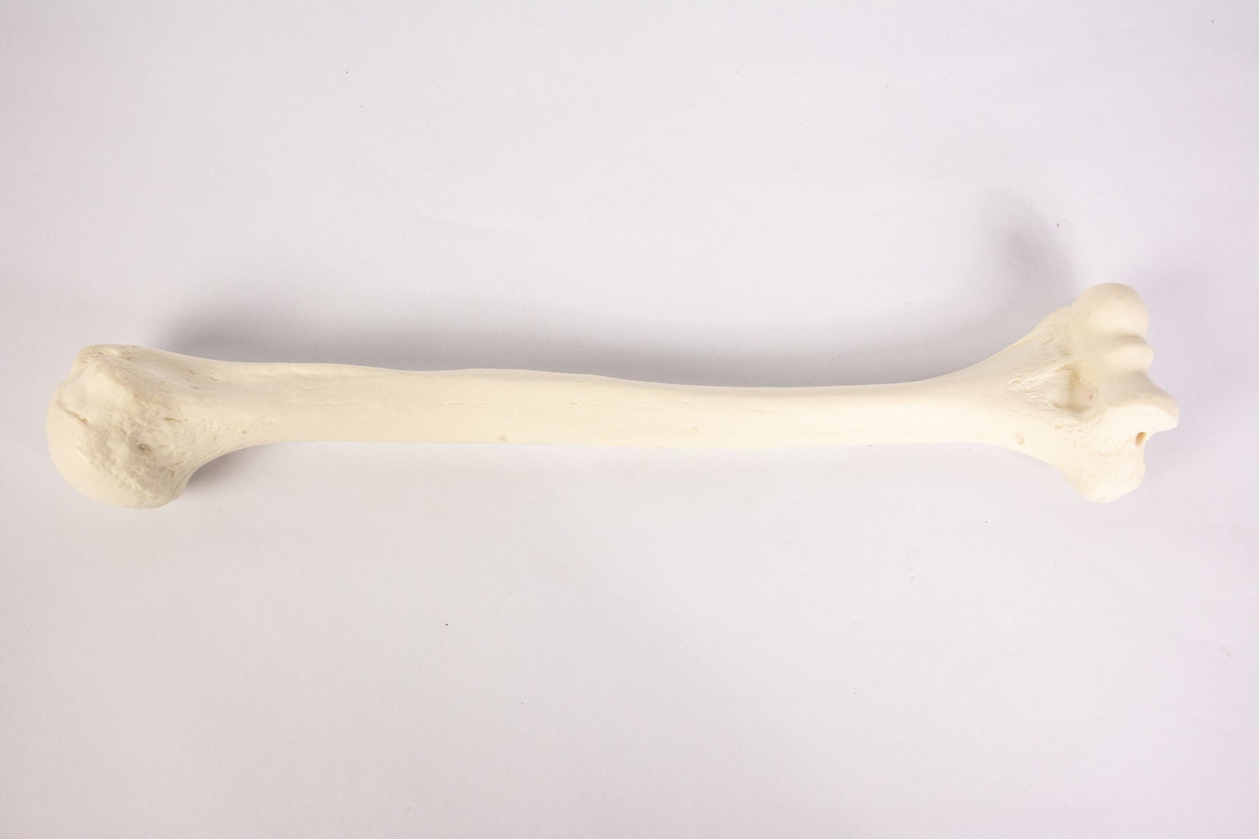 12327 - RADIOPAQUE LEFT HUMERUS WITH CANCELLOUS MATERIAL AND MEDULLARY CANAL