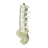 12470 - LUMBAR SPINE WITH SACRUM