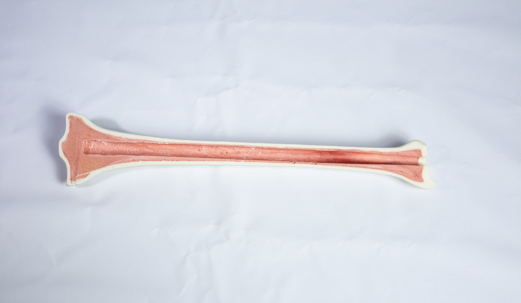 12372 - RADIOPAQUE RIGHT TIBIA WITH CANCELLOUS MATERIAL AND MEDULLARY CANAL