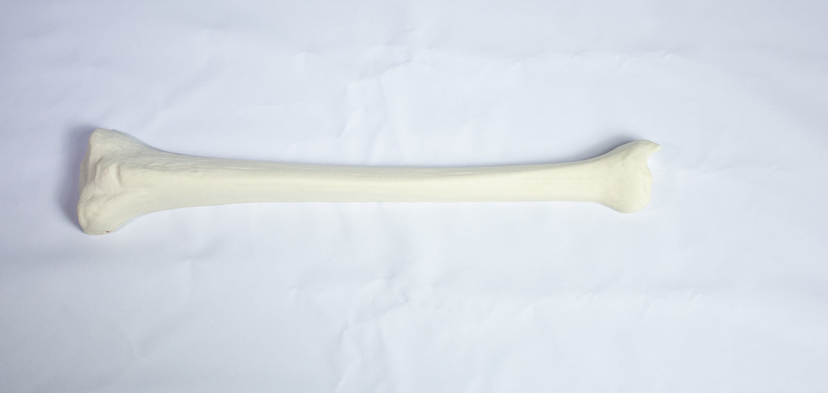 12372 - RADIOPAQUE RIGHT TIBIA WITH CANCELLOUS MATERIAL AND MEDULLARY CANAL