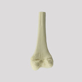 12371 - RADIOPAQUE LEFT JUVENILE DISTAL FEMUR