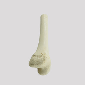 1013 D - LEFT JUVENILE DISTAL FEMUR