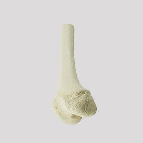 1013 D - LEFT JUVENILE DISTAL FEMUR