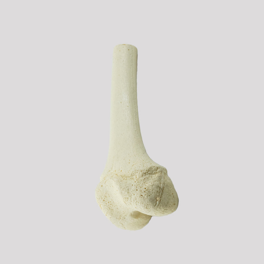 1013 D - LEFT JUVENILE DISTAL FEMUR