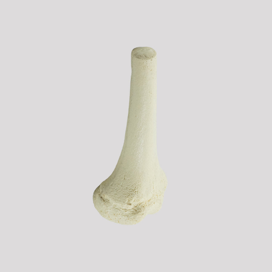 12371 - RADIOPAQUE LEFT JUVENILE DISTAL FEMUR