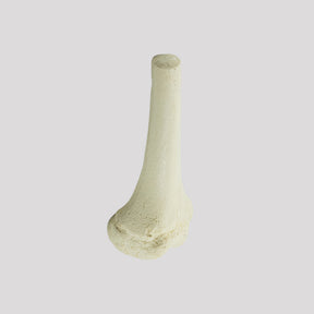 1013 D - LEFT JUVENILE DISTAL FEMUR