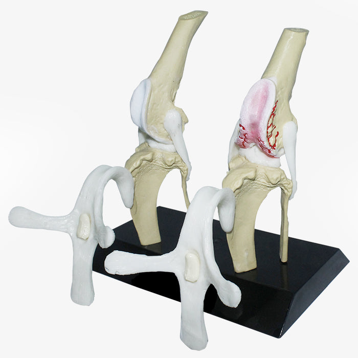 PV600-01 - CANINE STIFLE WITH ADVANCED OSTEOARTHRITIS