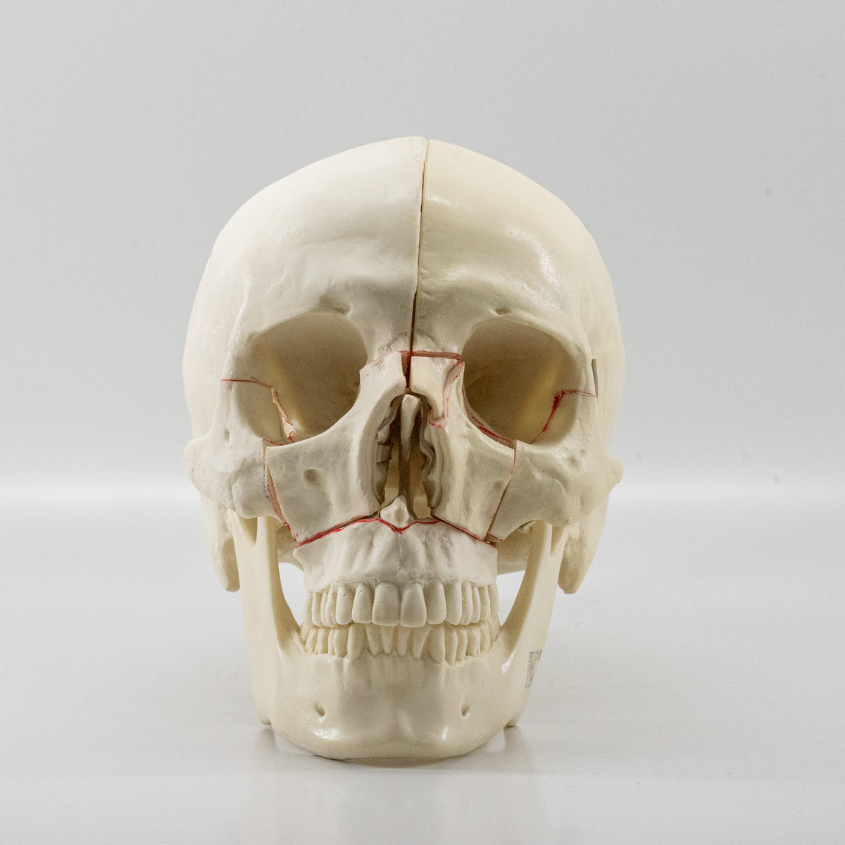 10559 - SKULL WITH MAXILLARY CUTS