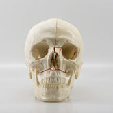 10559 - SKULL WITH MAXILLARY CUTS