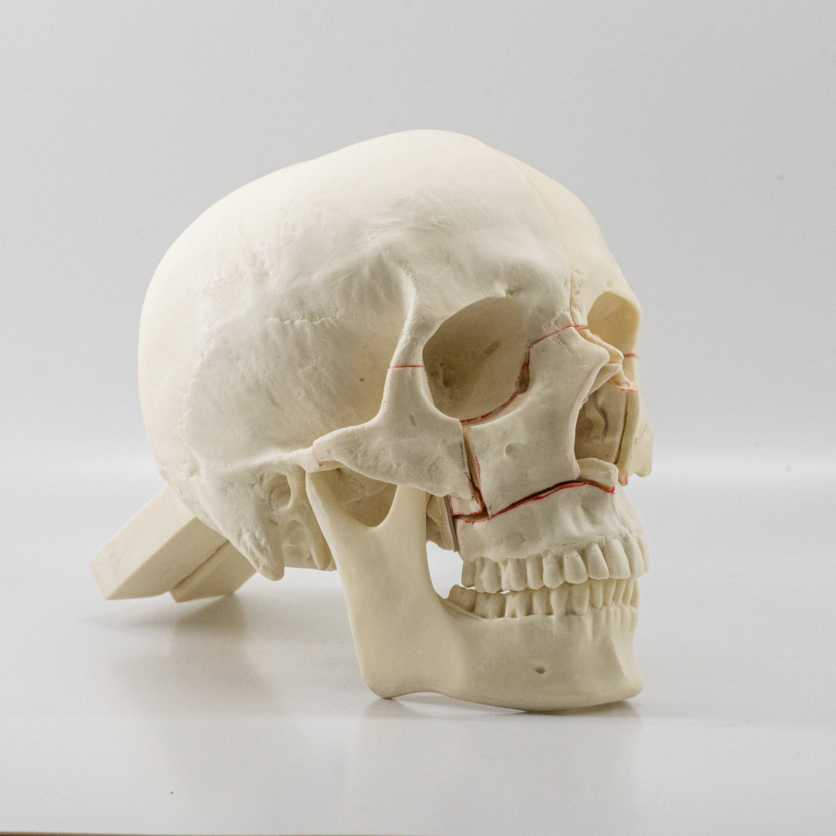 10559 - SKULL WITH MAXILLARY CUTS