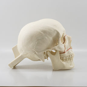 10559 - SKULL WITH MAXILLARY CUTS