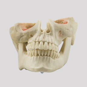 12789 - MODEL WITH SEVERE FACIAL ASYMMETRY