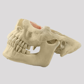 12789 - MODEL WITH SEVERE FACIAL ASYMMETRY
