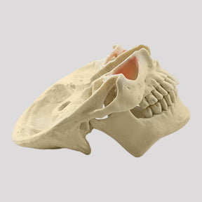 12789 - MODEL WITH SEVERE FACIAL ASYMMETRY