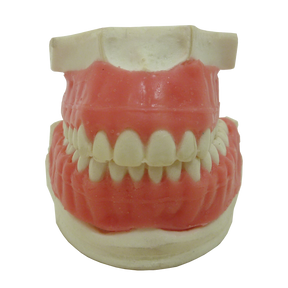 P4060G - ORTODONTIC MODEL IN PU WITH EXPOSED ROOT AND GINGIVA CUSTOMIZED WITH PALATINE GROOVES