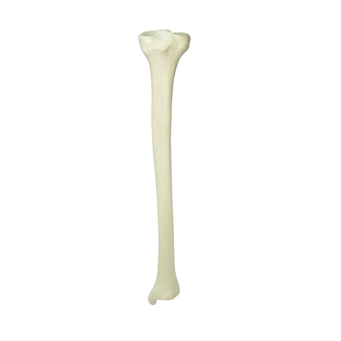 1011 - LEFT TIBIA WITH CANCELLOUS MATERIAL  AND MEDULLARY CANAL