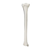 2026BESP - LEFT TIBIA WITH CANCELLOUS MATERIAL AND MEDULLARY CANAL